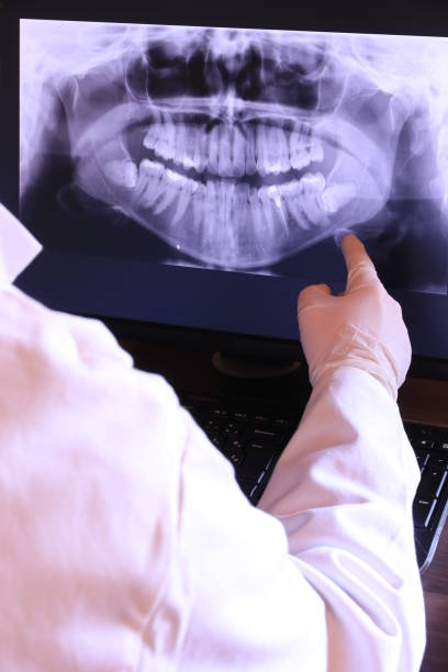 Best Emergency Tooth Extraction  in Rutherford College, NC