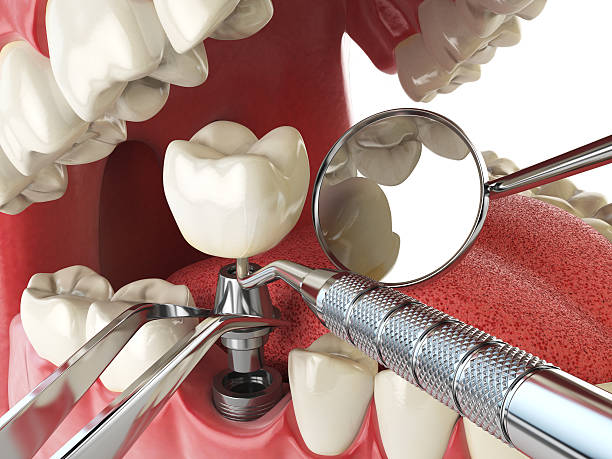 Dentist for Dental Trauma in NC