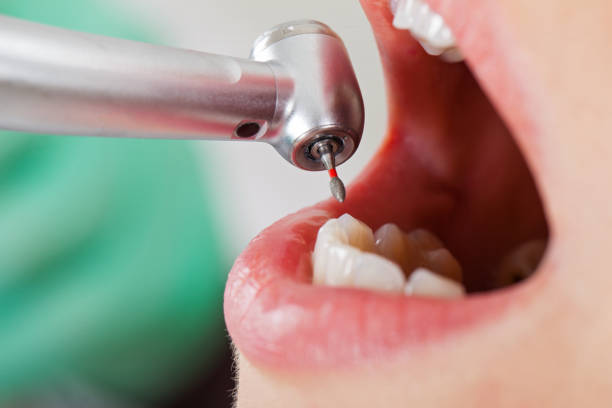 Best Chipped Tooth Repair Near Me  in Rutherford College, NC